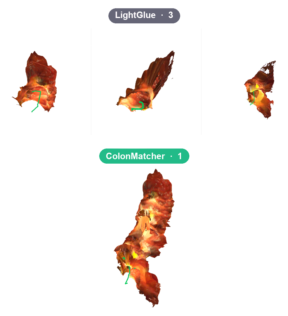 Comparación de reconstrucción 3D del colon: LightGlue de fábrica produce 3 mapas inconexos; ColonMatcher, 1 mapa coherente